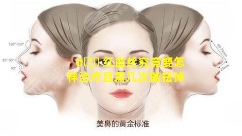 🦟 红血丝究竟要怎样治疗且需几次能祛掉